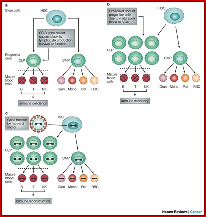 Occurrence of leukaemia following gene therapy of X-linked SCID