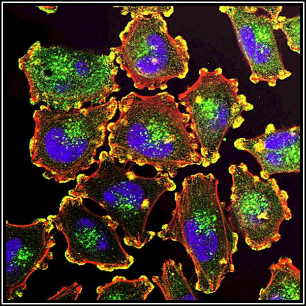 Podosome - Wikipedia