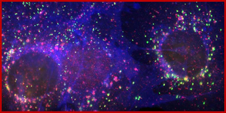 Immunofluorescence staining of LAMP-2 (green), the cholesterol transport protein NPC1 (red), and unesterified cholesterol (blue) in mouse fibroblasts. 