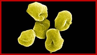 A new study indicates that plants, fungi, and animals are descendants of from archaea, the group of single-celled organisms that includes Sulfolobus, a resident of hot springs.