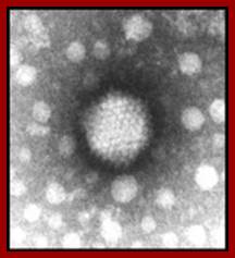 Negatively stained electron micrograph of adenovirus.