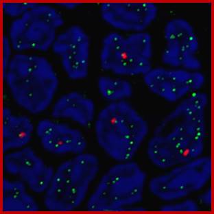 Thymocytes