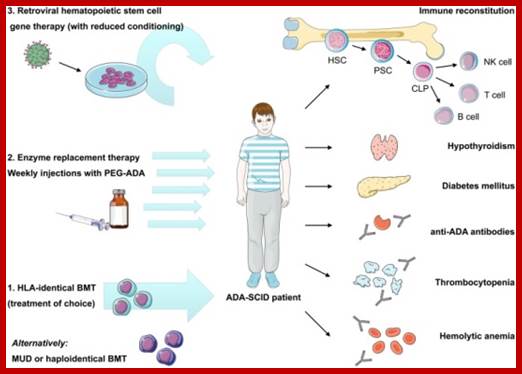 The current possible methods to cure ADA SCID.