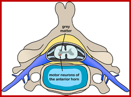 Polio spinal diagram.PNG