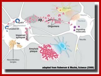 http://www.cmu.edu/biolphys/smsl/pictures/AD%20basics%20shadow.jpg