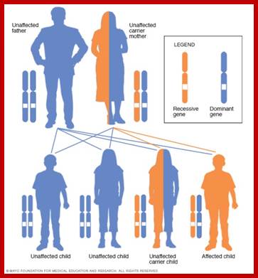 X-linked recessive inheritance pattern with carrier mother