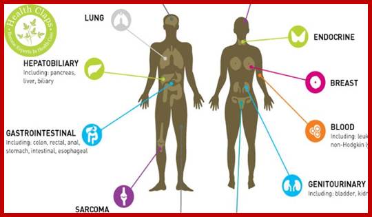 Description: What is the List of Most Common Cancer Types?