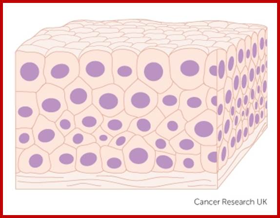 transitional cells