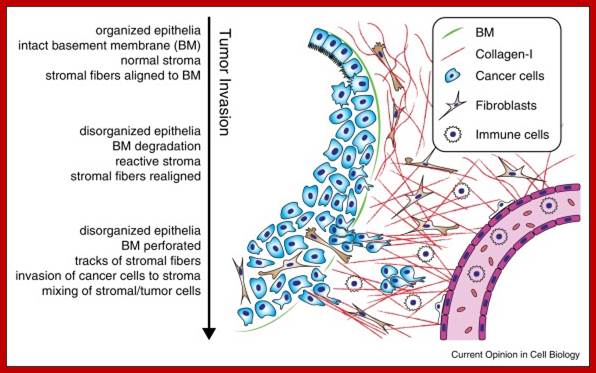 Image result for Cancer cells invading its neighboring cells and tissues