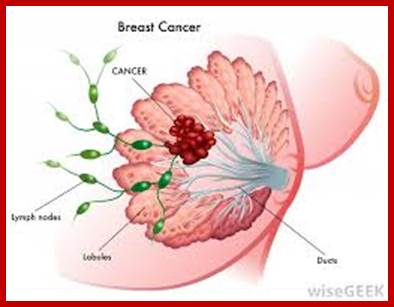 Image result for cancer tissue types