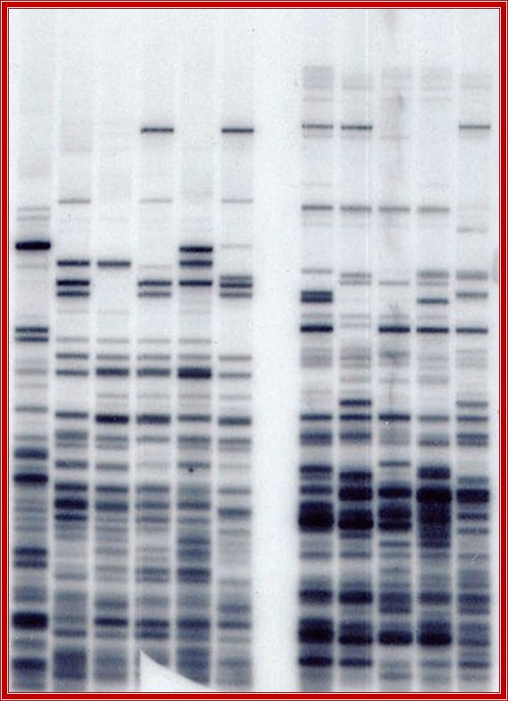 An early DNA fingerprinting experiment