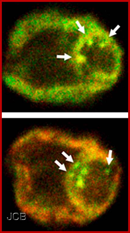 Stress granules in chloroplasts by TheJCB.