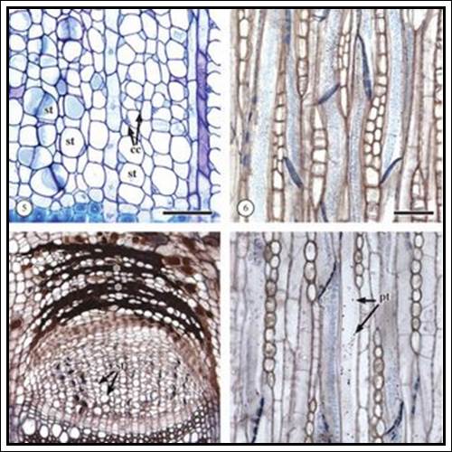 sieve-tube elements.-5: sieve-tubes (st) and their adjacent companion... |  Download Scientific Diagram